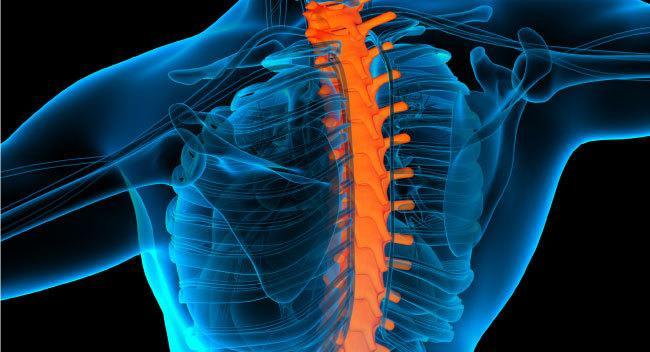patologías de columna vertebral Meliopatía